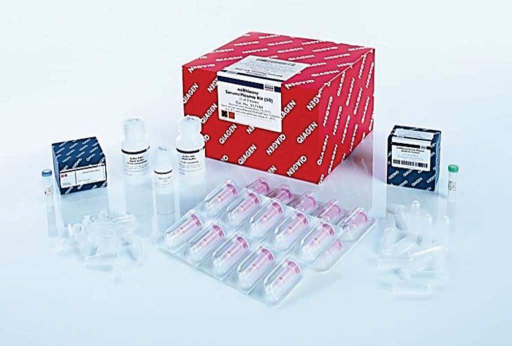 Image: The miRNeasy serum-plasma kit is designed for purification of cell-free total RNA (Photo courtesy of Qiagen).