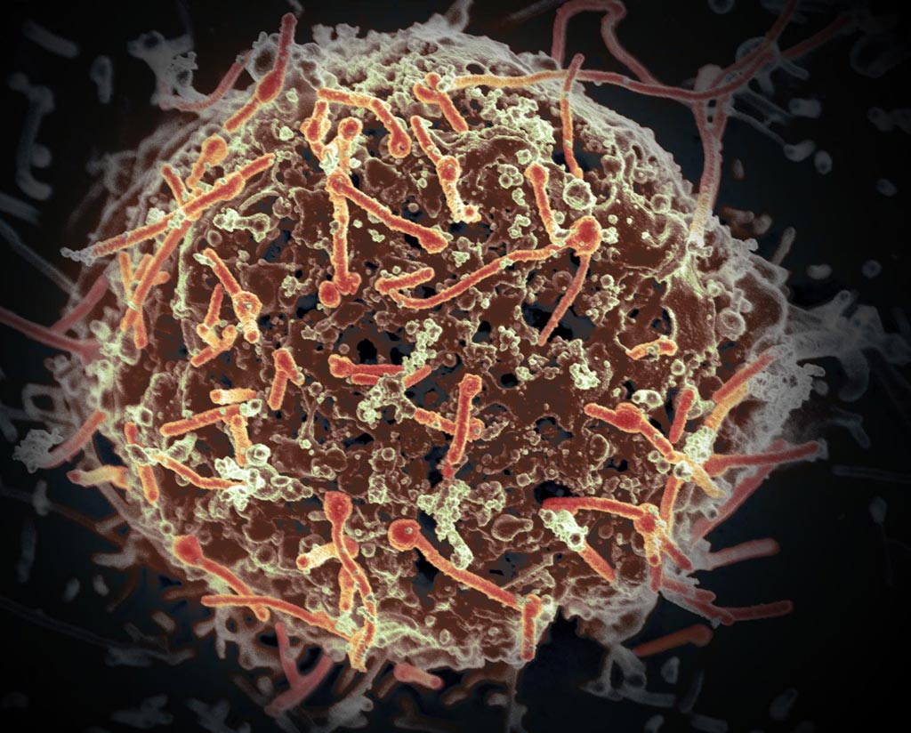 Image: The Ebola virus in human blood (Photo courtesy of Medical Xpress).