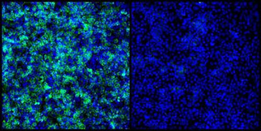 Image: Human placental cell line Jeg-3 can be readily infected by a circulating strain of Zika virus (left panel) and completely protected by treatment with nanchangmycin (right panel). All cells are shown in blue while virally infected cells are stained in green (Photo courtesy of Dr. Sara Cherry, University of Pennsylvania).