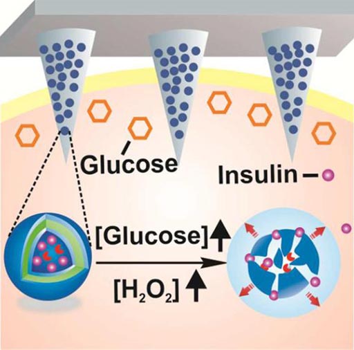 Image: Tiny, painless microneedles on a patch can deliver insulin in response to rising glucose levels (Photo courtesy of the ACS).