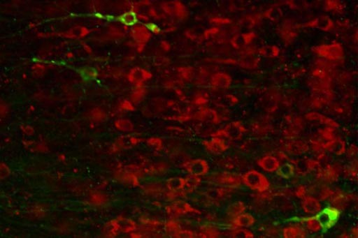 Image: Researchers have synthesized an antisense oligonucleotide (ASO) that can lower tau levels and prevent some neurological damage. In neurons that contain the ASO (above, in red) there are no tau tangles (in green) (Photo courtesy of Dr. Sarah DeVos, Washington University School of Medicine).