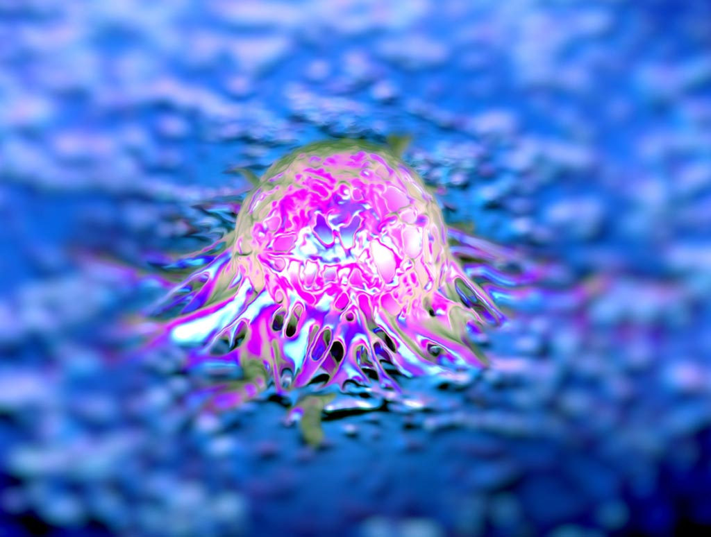 Image: A prostate cancer cell (Photo courtesy of ABM).