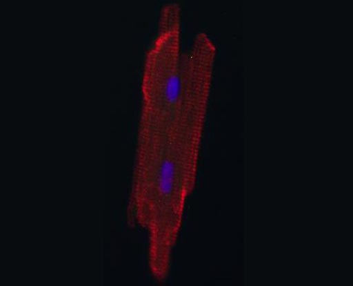 Image: An adult heart muscle cell, grown in a newborn rat heart (Photo courtesy of Chulan Kwon, Johns Hopkins University School of Medicine).