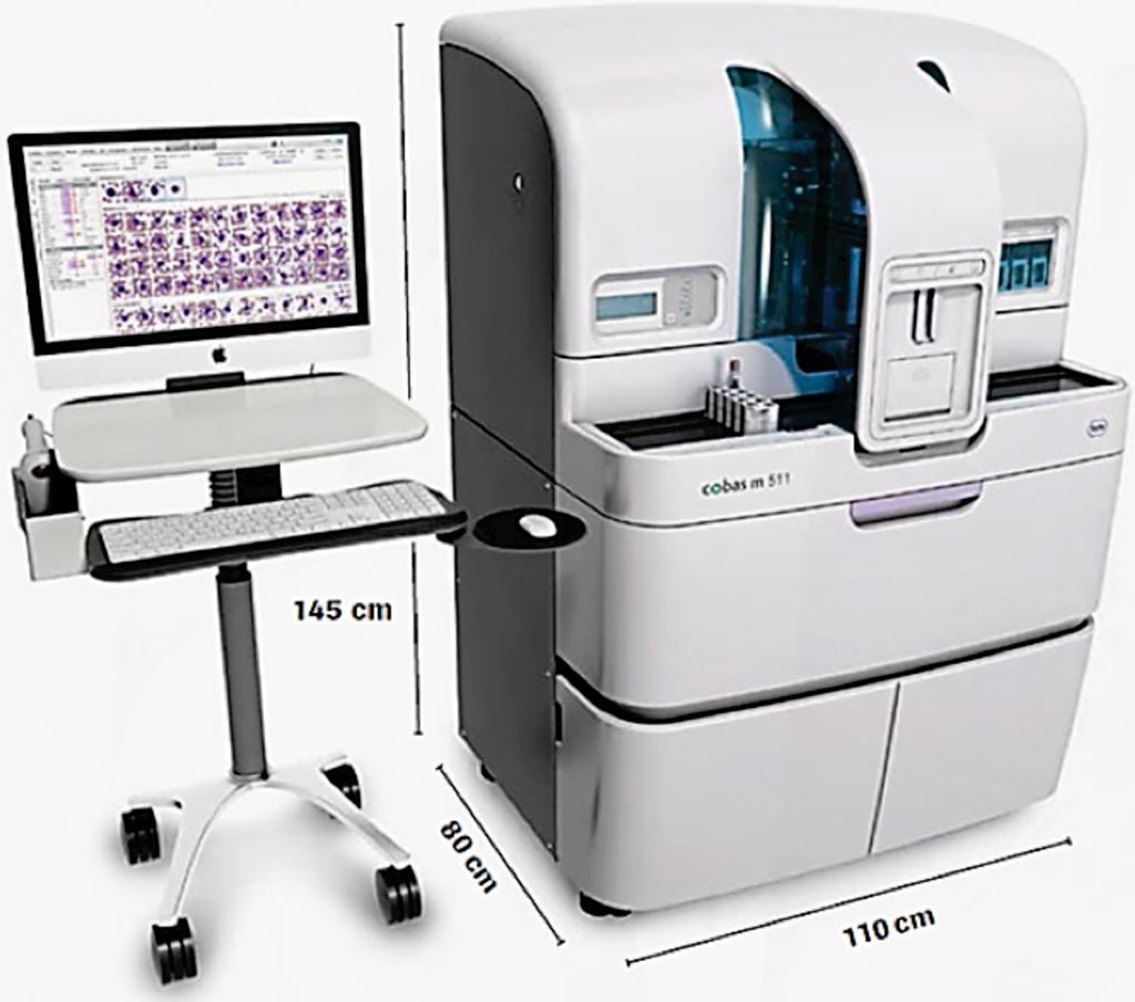 Image: The cobas m 511 integrated hematology analyzer (Photo courtesy of Roche).