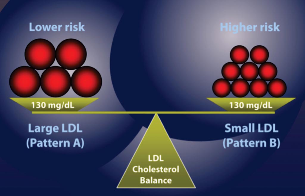 Image: Small, dense LDL particles have less anti-oxidants and are associated with a much higher risk of atherosclerosis. Large, buoyant LDL particles are rich in anti-oxidants and present a much lower risk of oxidizing than the small, dense LDLs (Photo courtesy of Dr. David Jockers).