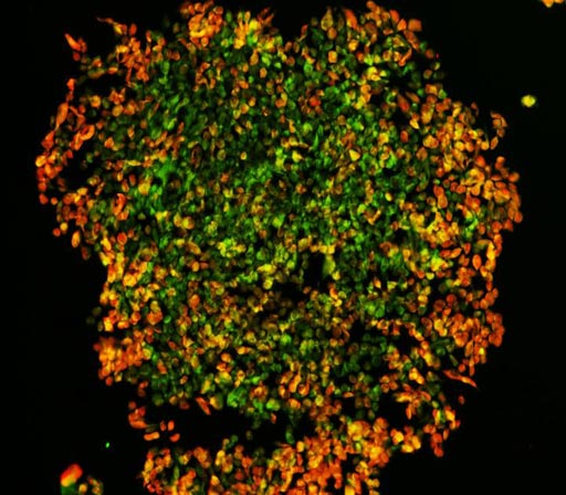 Image: A laboratory-generated melanoma tumor (Photo courtesy of Dr. Aaron Smith, Queensland University of Technology).