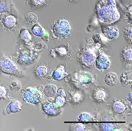 Image: Macrophages with ingested nanoparticles (green) (Photo courtesy of the Bourquin Laboratory, University of Geneva).