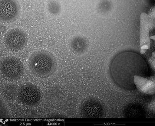 Image: A micrograph showing lipid nanoparticles (Photo courtesy of the University of the Basque Country).