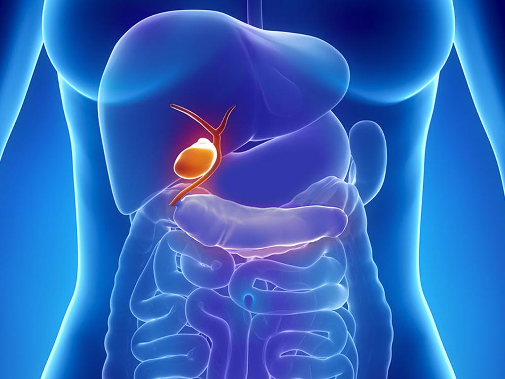 Image: Researchers have identified two genes that are associated with an increased risk of developing gallbladder cancer (Photo courtesy of Medscape).