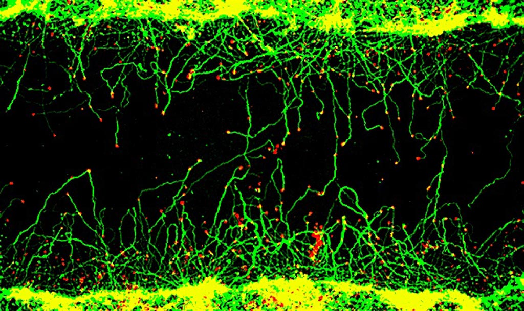 Image: Treatment with fusicoccin-A induces the regeneration of damaged axons towards the center of the injury. The axons are stained in green and the tips of the growing axons, called growth cones, are stained in red (Photo courtesy of McGill University).