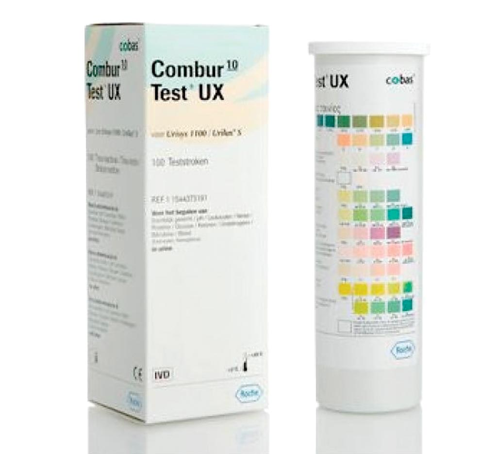 Image: The Combur 10 urinalysis test strips (Photo courtesy of Roche).