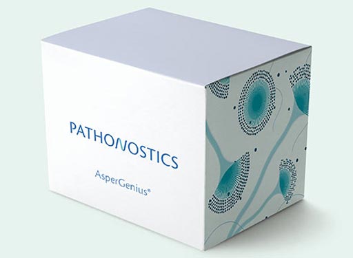 Image: The AsperGenius is a multiplex real-time PCR assay which rapidly diagnoses Aspergillus infections and simultaneously identifies multi-azole resistance (Photo courtesy of PathoNostics).