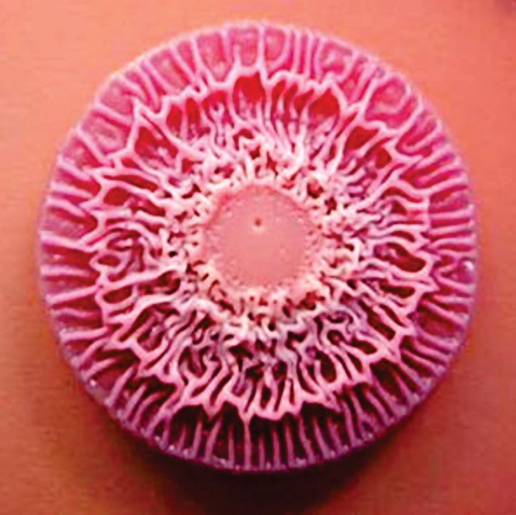Image: The Gram-negative Burkholderia pseudomallei in culture with its characteristic colony shape (Photo courtesy of MMG).