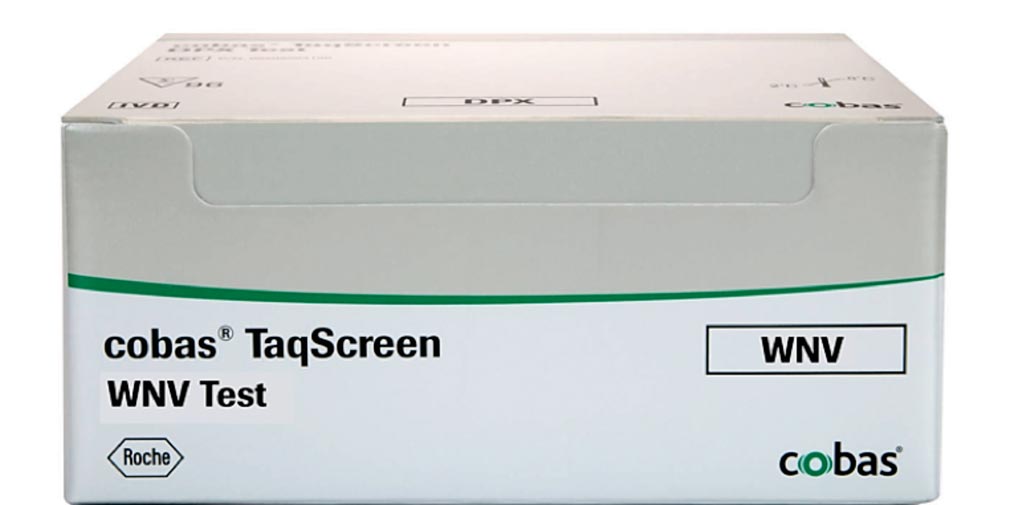 Image: The cobas TaqScreen WNV test: a real-time polymerase chain reaction (PCR) test to detect West Nile virus (WNV) RNA in plasma from blood, organ and tissue donor (Photo courtesy of Roche Diagnostics).