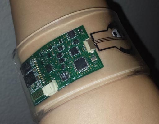 Image: A wearable sensor that extracts sweat and analyzes its constituents could be a useful device for diagnosing and monitoring diseases (Photo courtesy of Sam Emaminejad / Stanford School of Medicine).