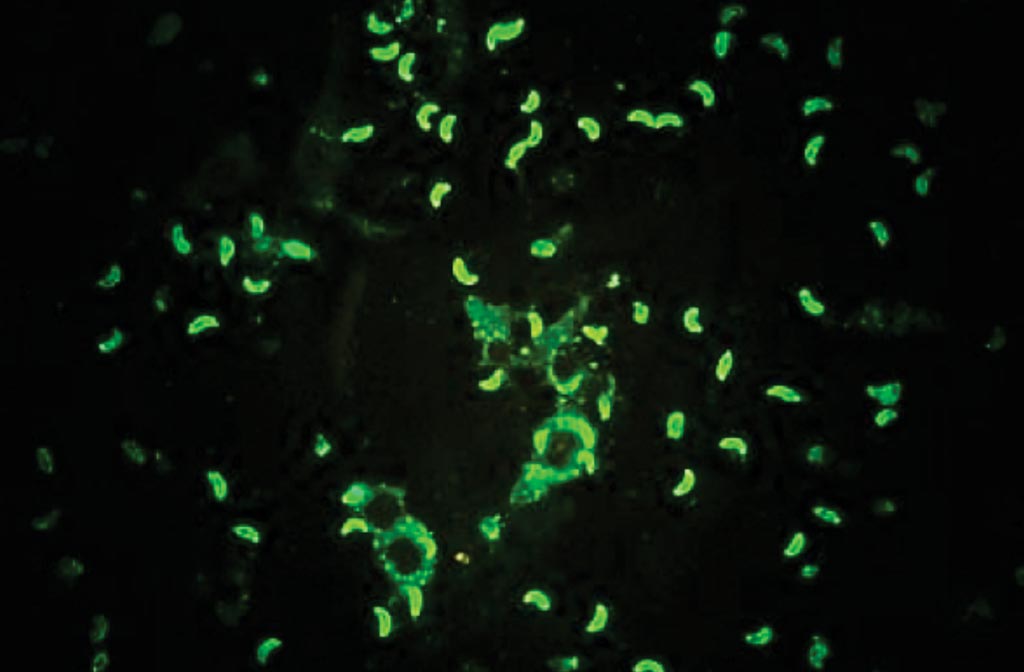 Image: Indirect fluorescent antibody test for Toxoplasma gondii, diffuse staining is considered positive (Photo courtesy of SPL).