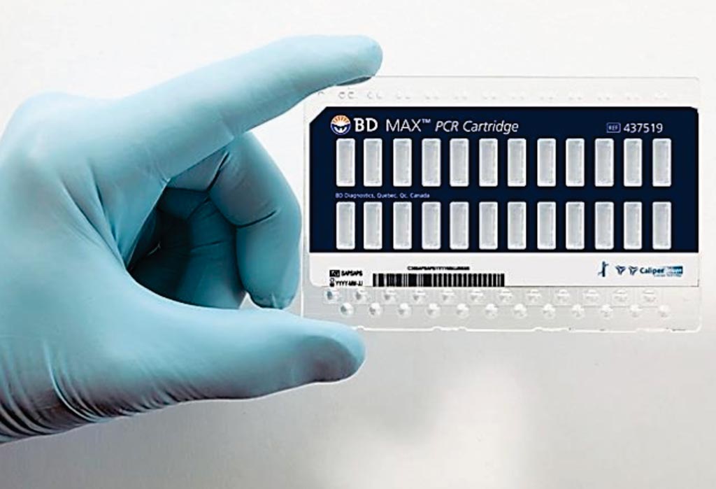 Image: A Polymerase Chain Reaction (PCR) processing card for the BD Max molecular diagnostics platform (Photo courtesy of BD Diagnostic Systems).