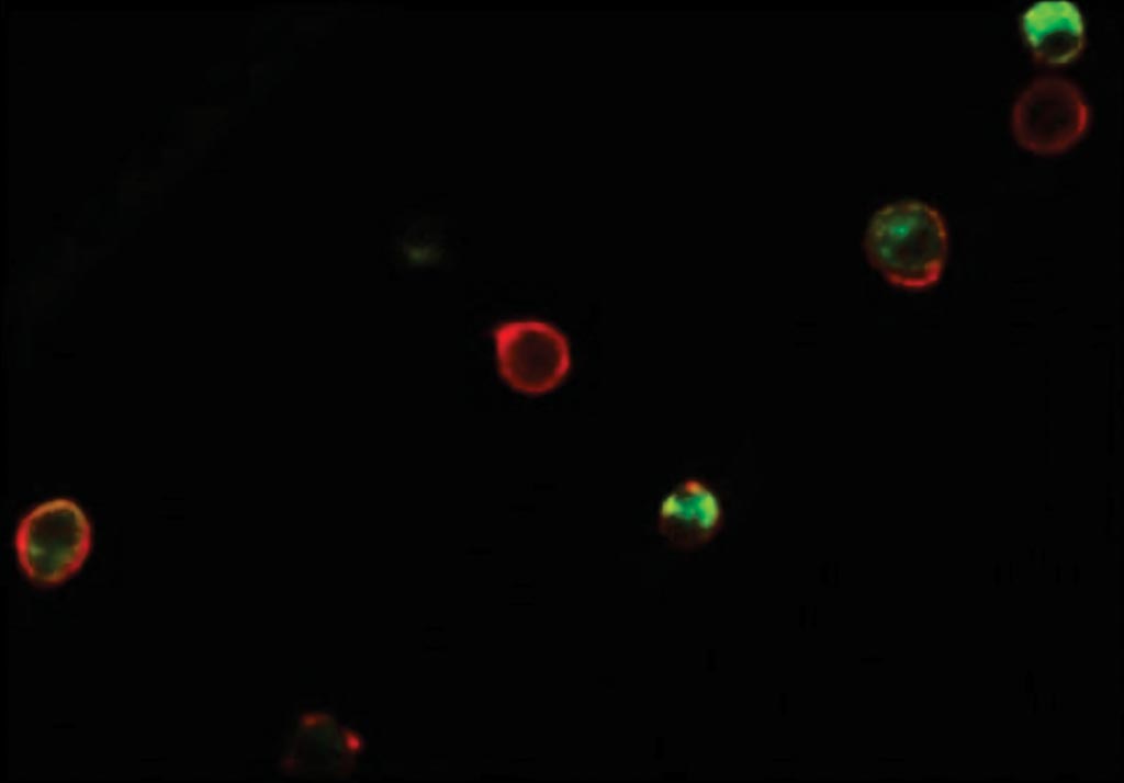Image: Fluorescence micrograph of captured plasma cells from a clinical sample. Red fluorescence denotes CD138, while green denotes κ light chain antibody (Photo courtesy of Massachusetts Institute of Technology).