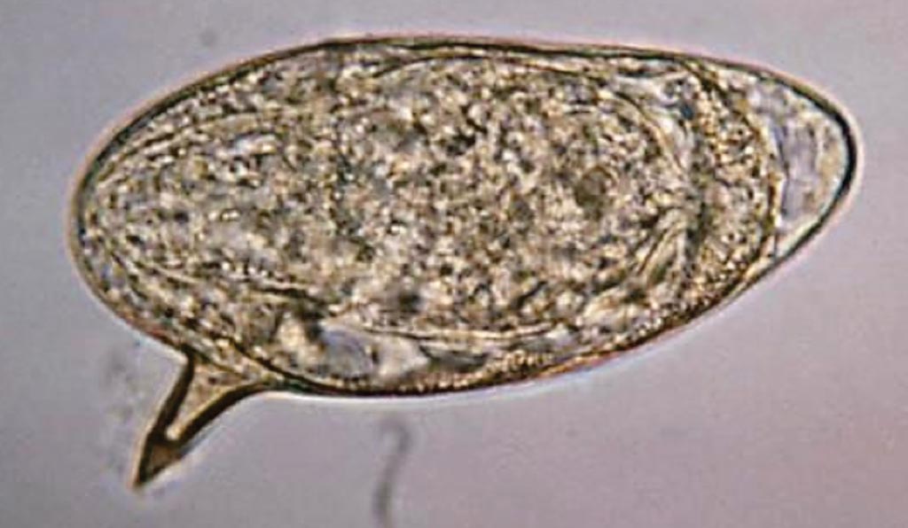 Image: A photomicrograph of an egg from the parasite Schistosoma mansoni reveals the egg’s characteristic lateral spine, from a stool specimen (Photo courtesy of the CDC).