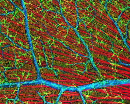 Image: A confocal micrograph of mouse retina depicting optic fiber layer (Photo courtesy of the National Center for Microscopy and Imaging Research, University of California, San Diego).