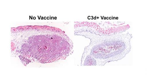 Image: When free C3d vaccine was added to a tumor, the cancer cells began to die (right). Tumor cells not given the vaccine continued to grow (Photo courtesy of the University of Michigan).