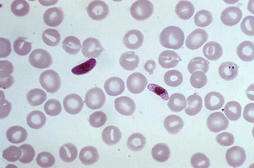 Image: A photomicrograph of a blood smear containing a macro- and microgametocyte of the Plasmodium falciparum parasite (Photo courtesy of the CDC).