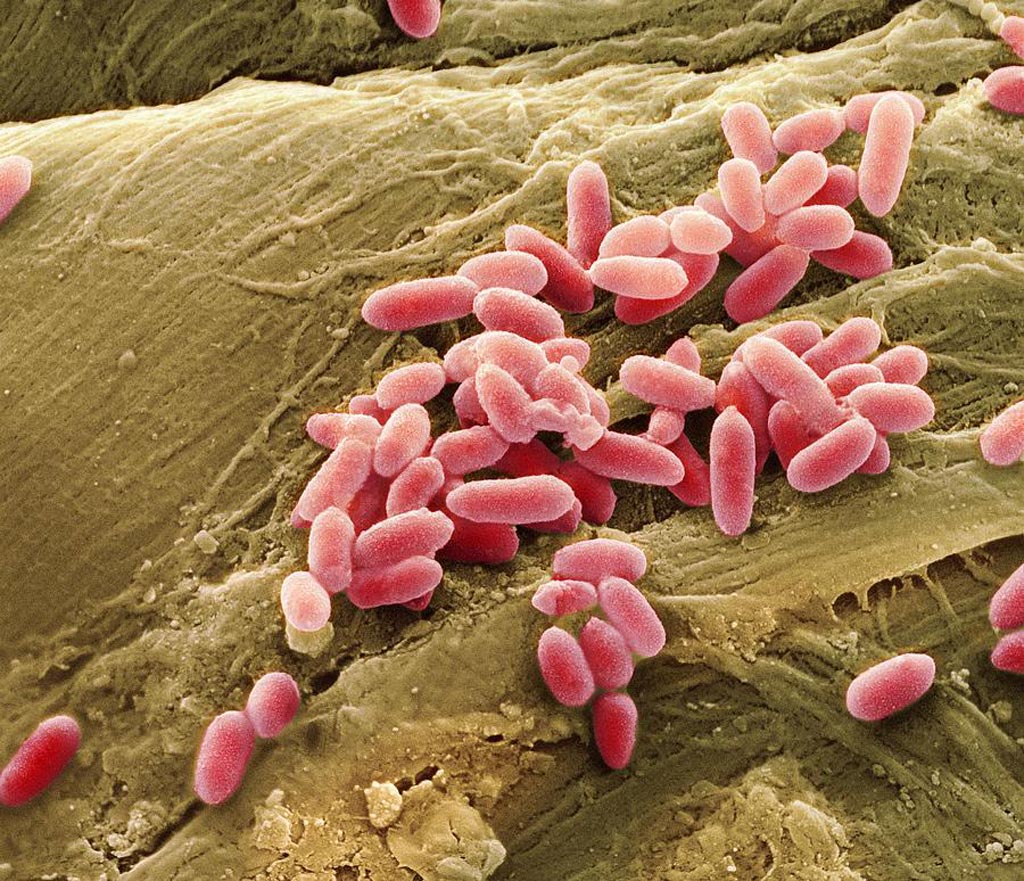 Image: A scanning electron micrograph (SEM) of Pseudomonas aeruginosa bacteria (Photo courtesy of SPL).