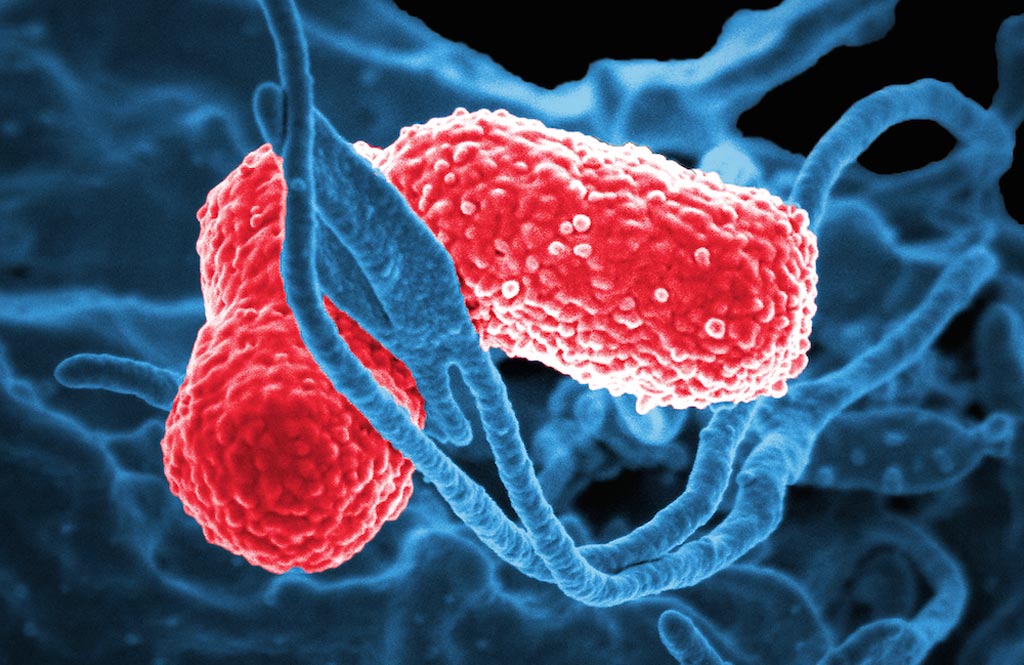 Image: A scanning electron micrograph (SEM) of multidrug-resistant Klebsiella pneumoniae gram-negative bacteria that are known to cause severe hospital-acquired infections (Photo courtesy of Dr. David Dorward, PhD).