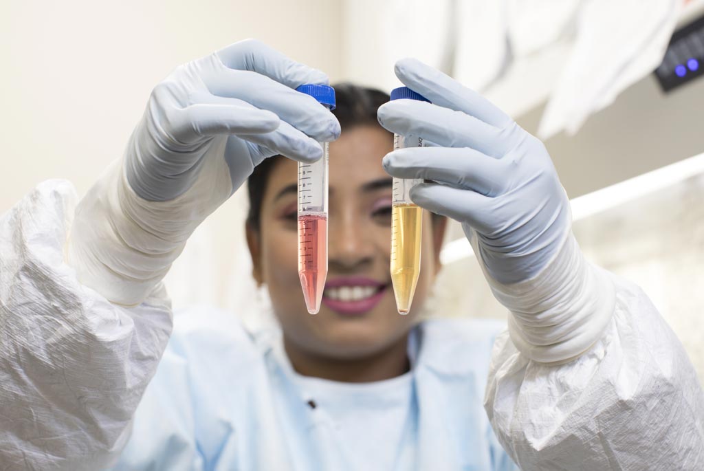 Image: Anwesha Sanyal, PhD, indicates HIV-infected cells collecting at the bottom of a test tube being prepared for the TZA test. The yellow color indicates the stimulated (Photo courtesy of the University of Pittsburgh).