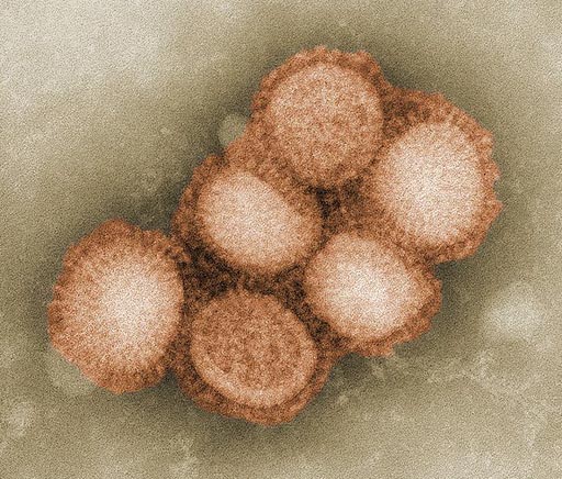 Image: A colorized negative stained transmission electron micrograph (TEM) depicting influenza virus ultrastructural morphology (Photo courtesy of the CDC).