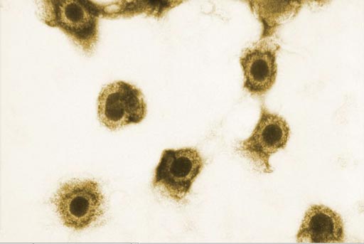 Image: Cytomegalovirus. According to a new study, HIV-positive women with cytomegalovirus (CMV) in their urine at the time of labor and delivery are over five times likelier to transmit HIV than HIV-positive women without CMV (Photo courtesy of the CDC).