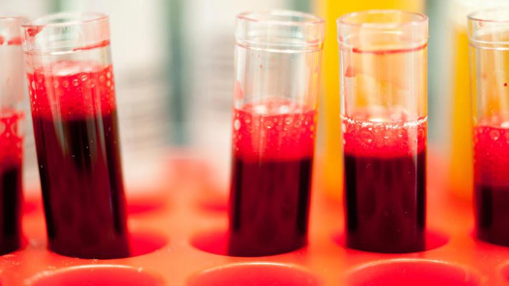 Image: Blood samples being prepared for the Three-In-One Blood Test that predicts a patient\'s response to PARP inhibitors (Photo courtesy of The Institute of Cancer Research).