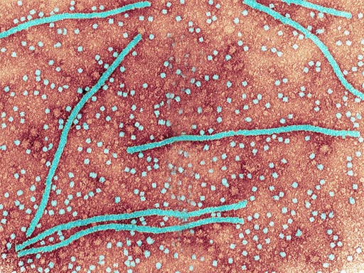 Image: A transmission electron micrograph (TEM) image of Potato X virus (Photo courtesy of SPL).