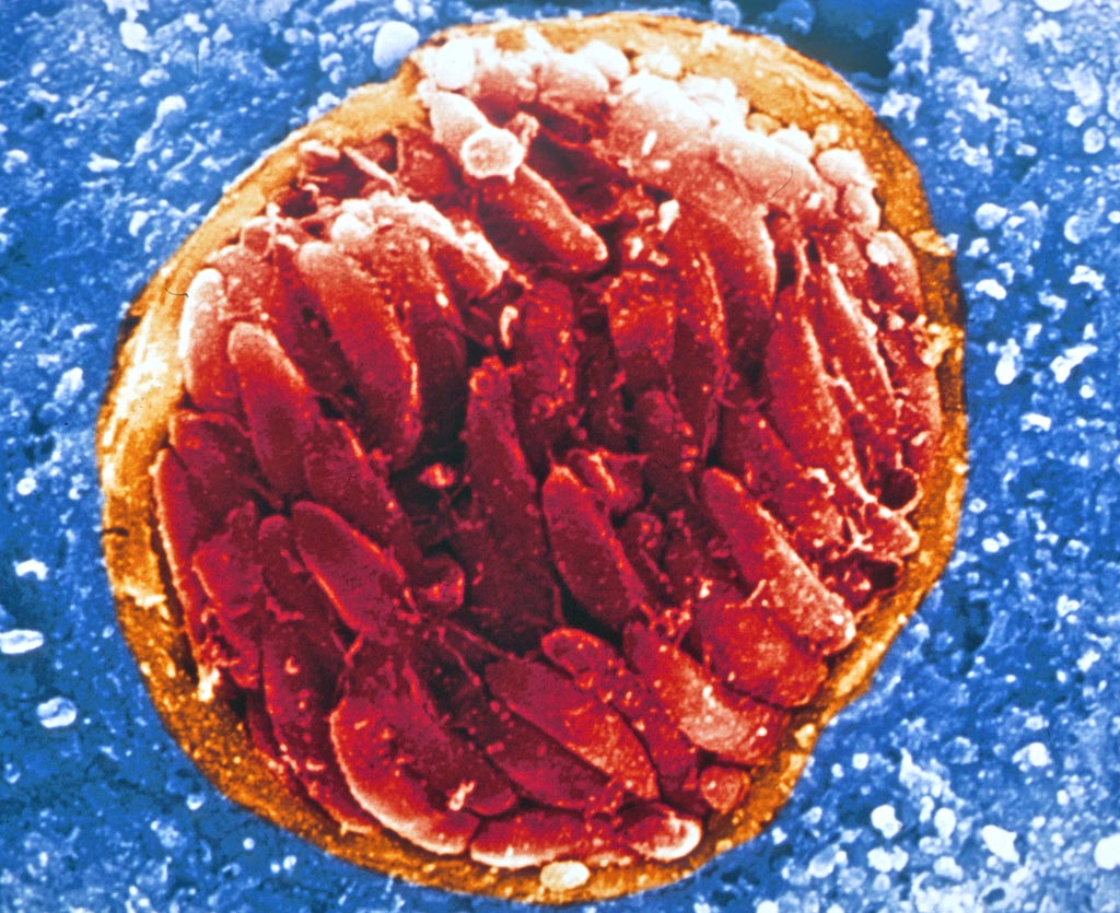 Image: Toxoplasma gondii, the protozoan responsible for toxoplasmosis in humans (Photo courtesy of Science Life).