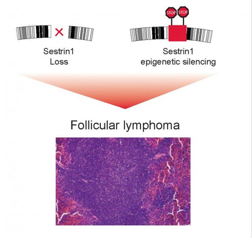 Image: Disruption of a region in chromosome 6 or epigenetic modifications of the DNA block SESTRIN1 expression contribute to the development of follicular lymphoma (Photo courtesy of Elisa Oricchio and Natalya Katanayeva, Ecole Polytechnique Fédérale de Lausanne).