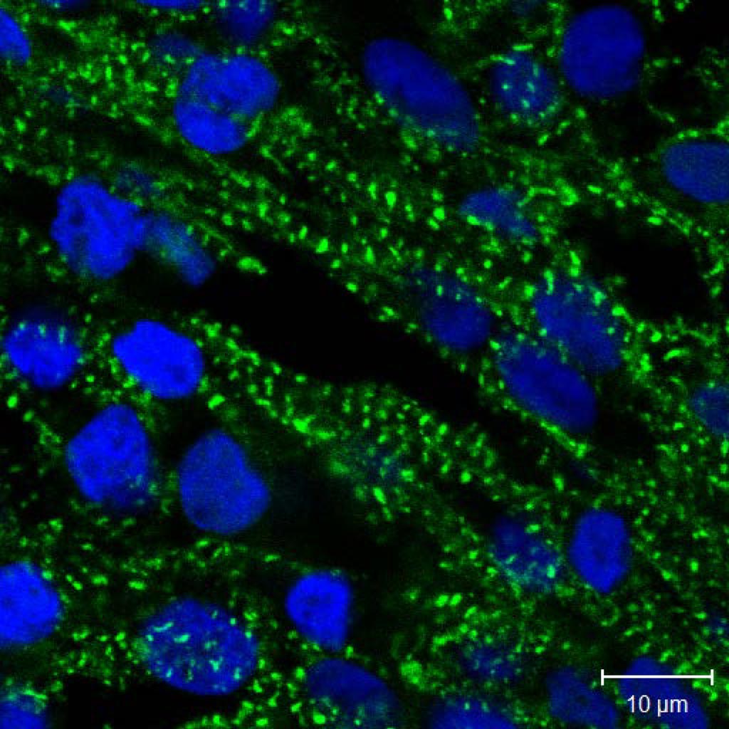Image: Human heart muscle cells growing in the 3D tissue structure. The cells have been stained with fluorescent molecules to identify the nuclei (blue) and cardiac-specific protein (green) (Photo courtesy of IBN at A*STAR).