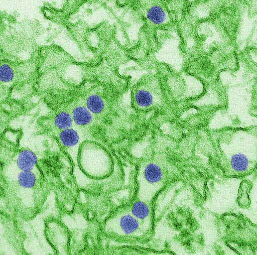 Image: Digitally colorized transmission electron microscopic (TEM) image of Zika virus, which is a member of the family Flaviviridae. Virus particles, here colored red, are 40 nanometers in diameter, with an outer envelope, and an inner dense core (Photo courtesy of Cynthia Goldsmith, CDC).