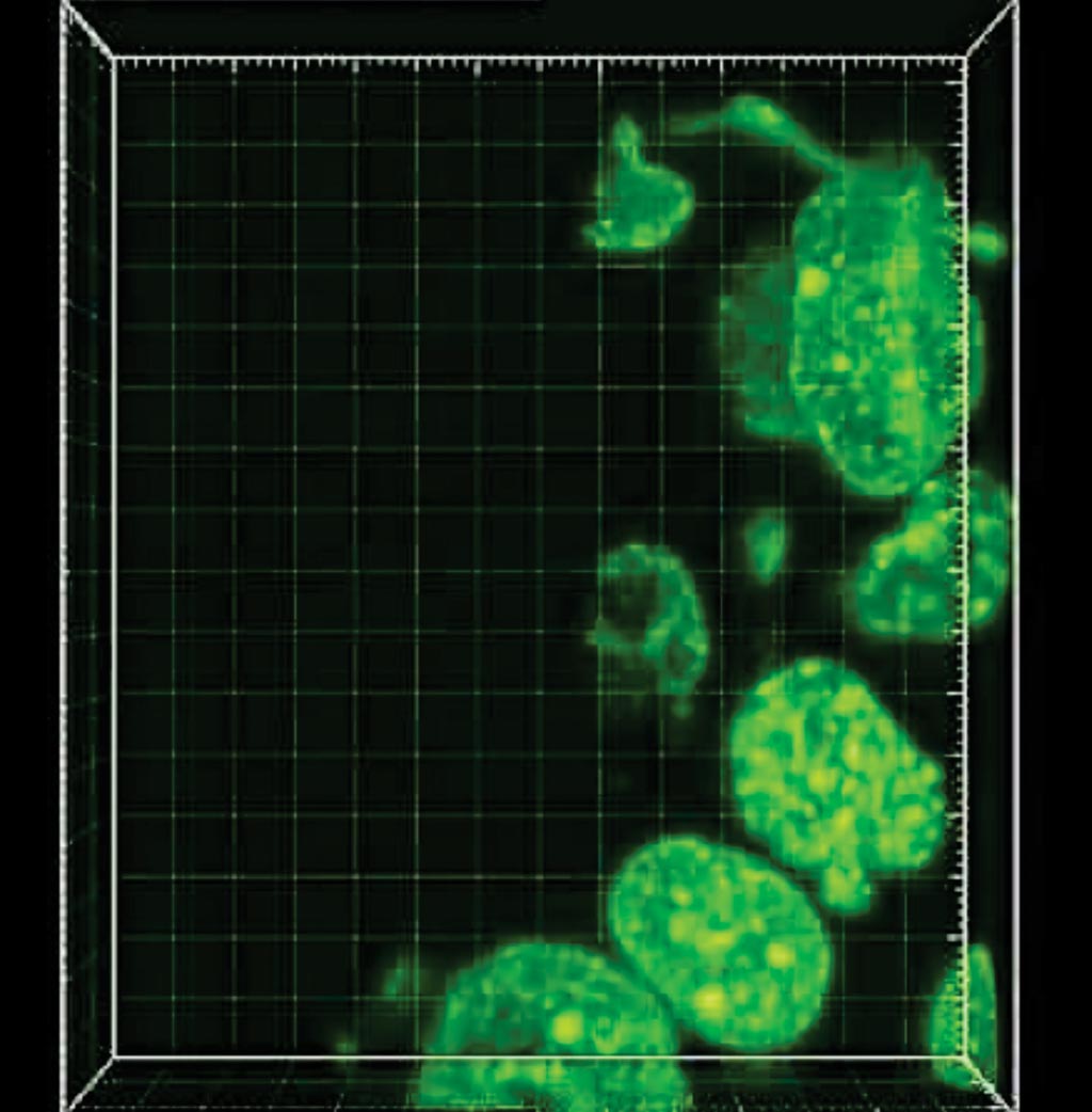 Image: The expansion pathology (ExPath) technique reveals expanded breast cancer tissue with nuclei visualized in 3D (Photo courtesy of the Ludwig Institute for Cancer Research).
