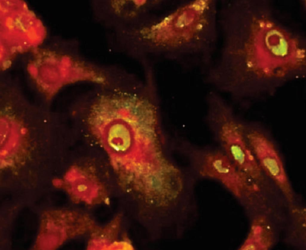 Image: Immunofluorescent antibody stain showing positive Powassan virus-infected cells (Photo courtesy of Coppe Laboratories).