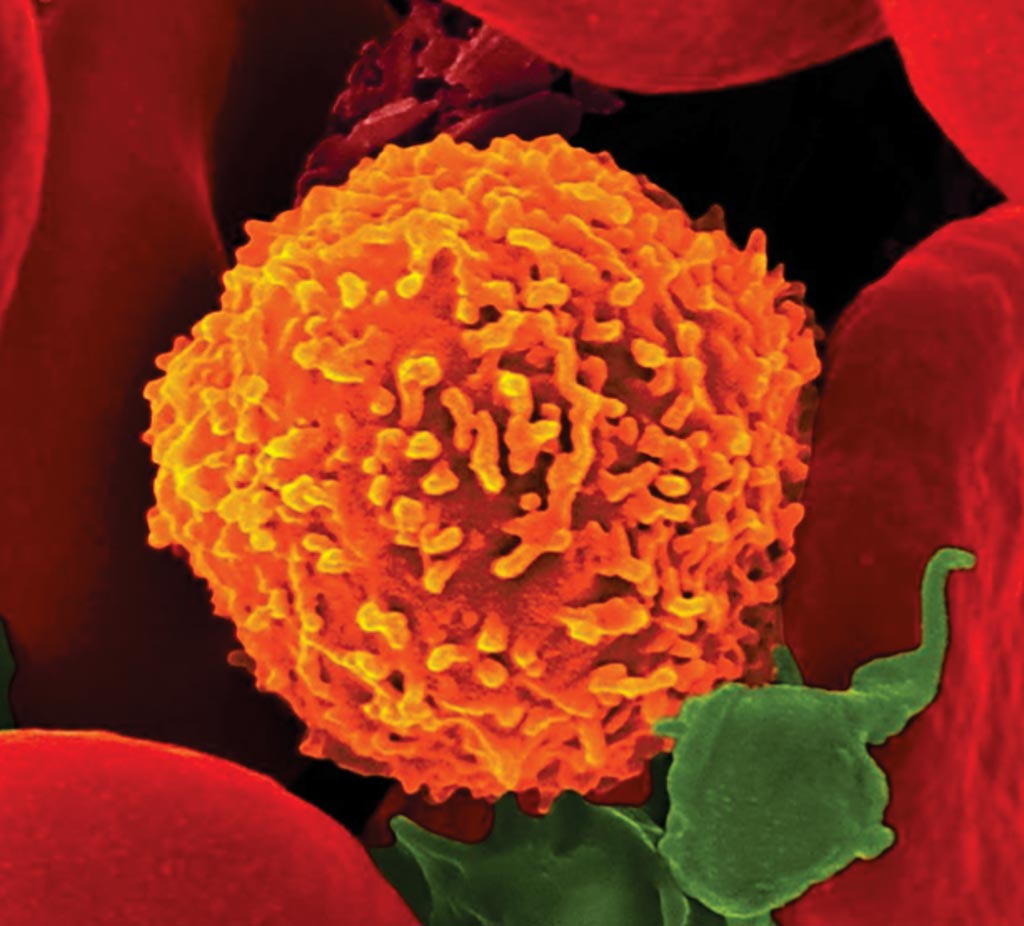 Image: A scanning electron micrograph of a CD8+ T cell engaging a virus (Photo courtesy of Dennis Kunkel).