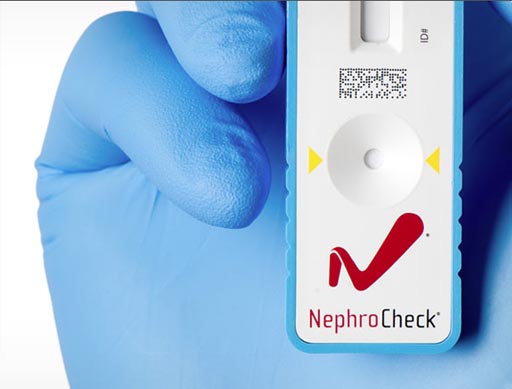 Image: The VITROS NephroCheck test (Photo courtesy of Ortho Clinical Diagnostics).