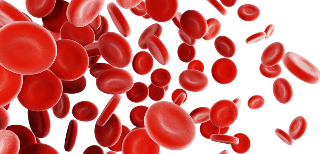 Повышение эритроцитов у мужчин. Эритроциты в крови анемия. Молекула крови. Клетки крови являющиеся носителями гемоглобина.