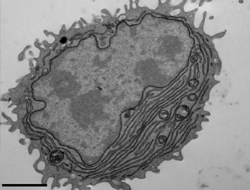 Image: An electron microscopy image showing an antibody-secreting plasma cell generated using antigen- and CpG-coated nanoparticles (Photo courtesy of Sanjuan Nandin et al., 2017).