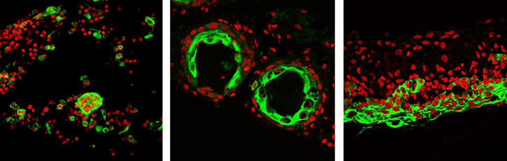 Image: Two types of progenitor cells from dissociated skin – epidermal (green) and dermal (red) – undergo a series of morphological transitions to form reconstituted skin (Photo courtesy of Mingxing Lei / Cheng-Ming Chuong Lab).