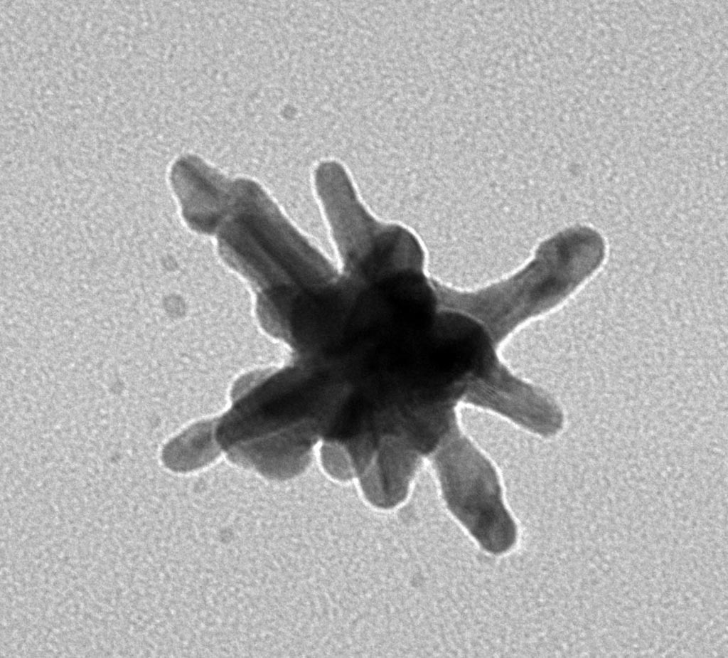 Image: A scanning electron micrograph (SEM) of a gold nanostar. The nanostar\'s size caused it to accumulate within tumors, where researchers used infrared light to heat it and destroy cancerous growths (Photo courtesy of Dr. Tuan Vo-Dinh, Duke University).