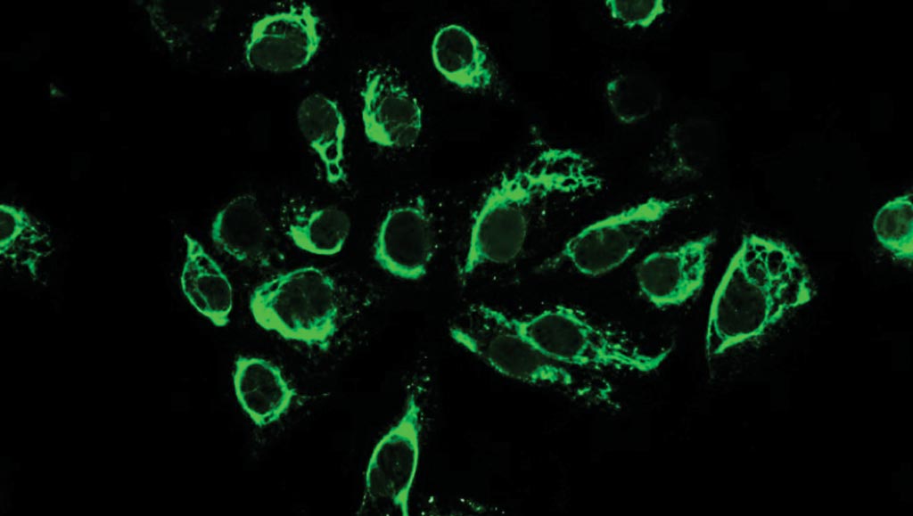 Image: ELISA and indirect immunofluorescence tests (IIFT) have been developed for sensitive and specific detection of antibodies against Zika virus in patient serum samples (Photo courtesy of EUROIMMUN).