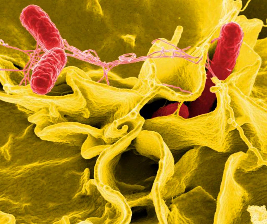 Image: Digitally colorized scanning electron microscopic image showing Salmonella Typhi bacteria (red) invading an immune cell (yellow) (Photo courtesy of the CDC Public Health Image Library).