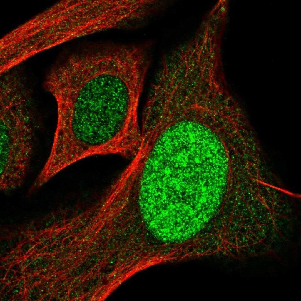 Image: Staining of human cell line U-2 OS with fluorescently labeled SP110 antibody shows localization of the protein to the nucleus (Photo courtesy of Novus Biologicals).
