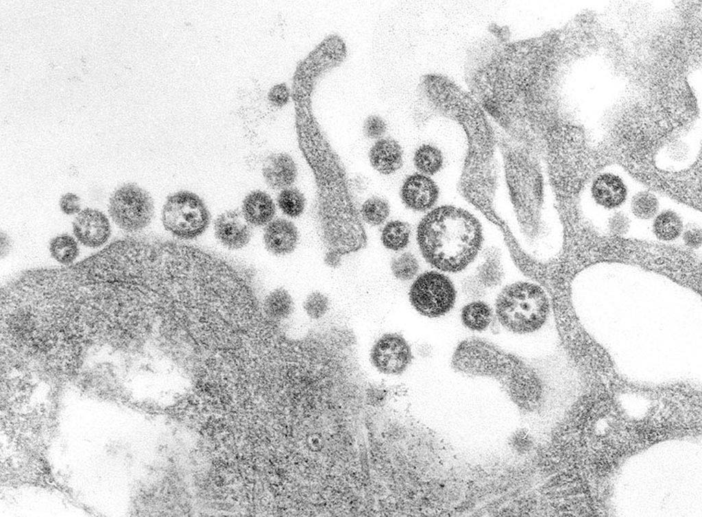 Image: A transmission electron micrograph (TEM) of a number of Lassa virus virions adjacent to some cell debris. The virus, a member of the virus family Arenaviridae, causes Lassa fever (Photo courtesy of the CDC).