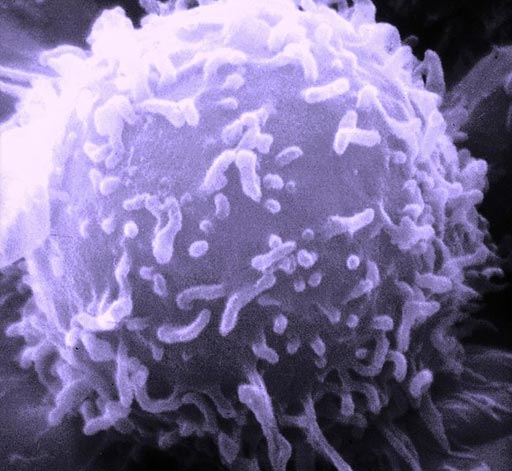 Image: A scanning electron microscope (SEM) image of a single human lymphocyte (Photo courtesy of the National Cancer Institute).